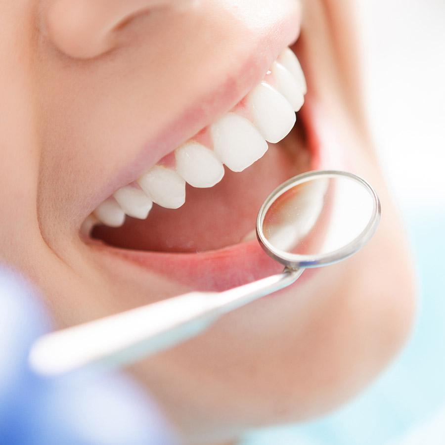 composite fillings, mercury alternatives in Irvine, CA