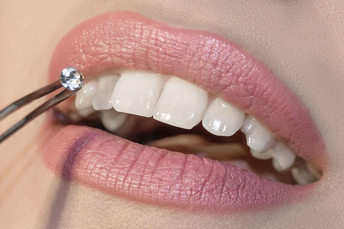 Enhance Your Smile with Tooth Gems at Tooth Love