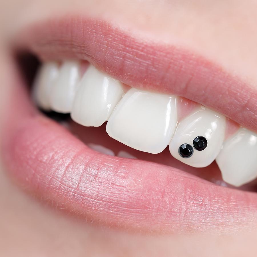 tooth gems placement by Irvine dentist Joanna Jefferson, DDS